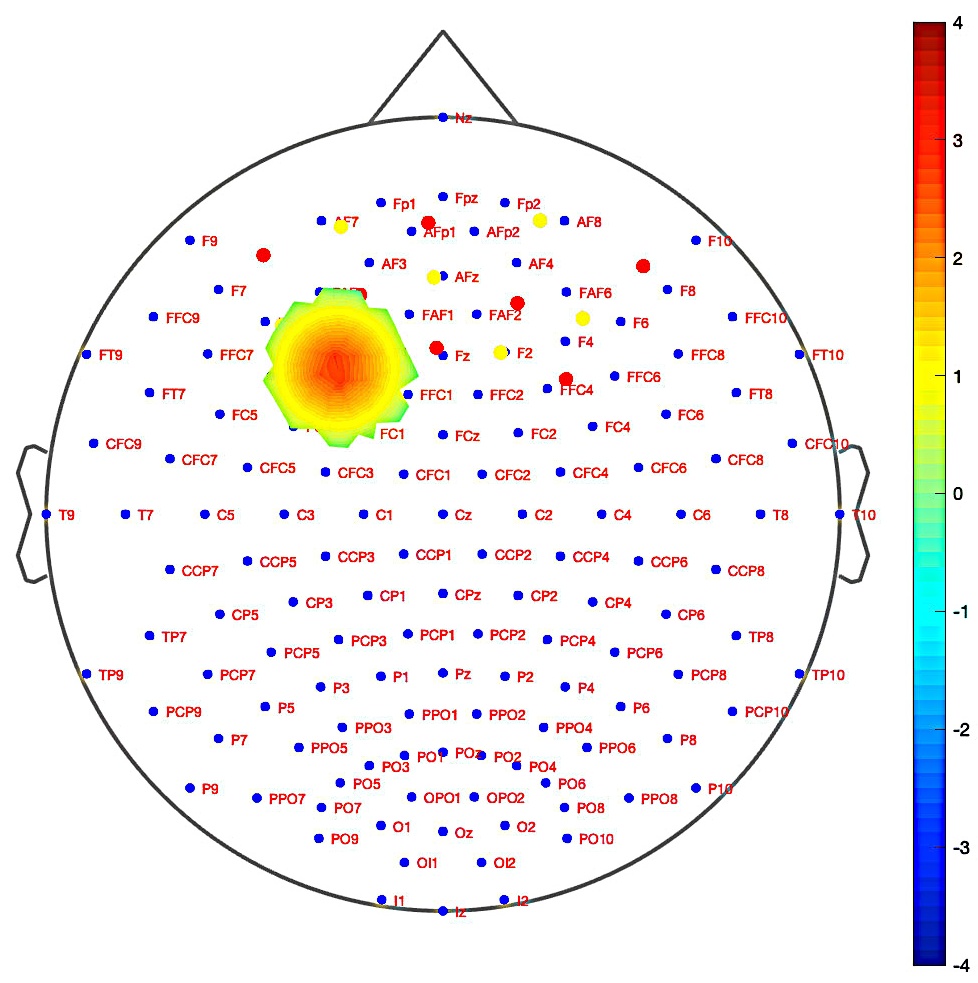 Topographic images of the PFC showing activation patterns in
response to incongruent stimuli, derived from changes in activation levels across
participant groups using the CNR method.