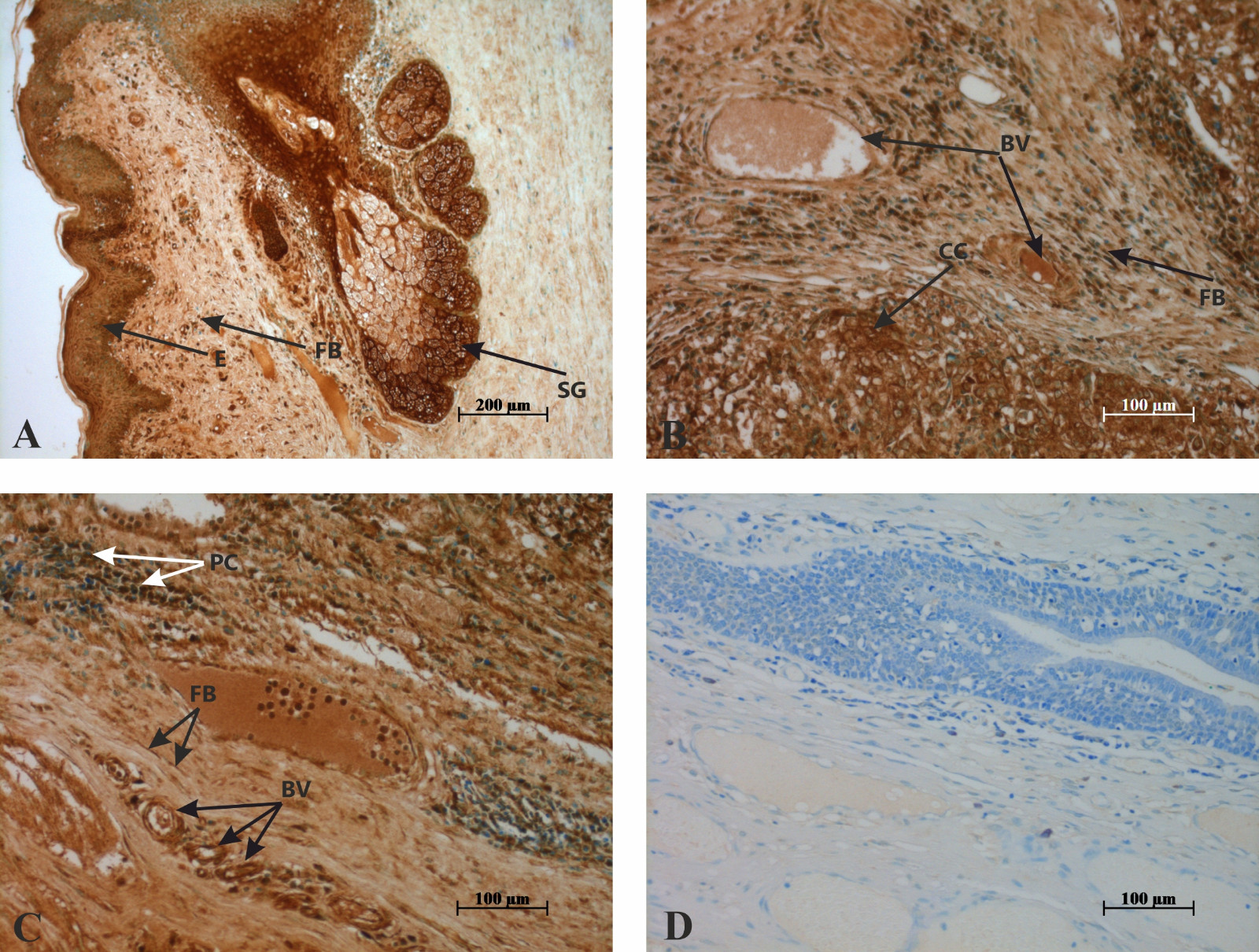 Immunohistochemistry results. Localization of FSH receptors in
human penile tissue. (A) FSH receptors are visible in cells of the sebaceous
gland (SG), throughout all layers of the epithelium (E), and in the fibroblasts
of subepithelial connective tissue (FB). (B) FSH receptors are detected in the
corpus cavernosum (CC), fibroblasts of connective tissue (FB), and in the intima
of small blood vessels (BV). (C) The presence of FSH receptors is noted in
fibroblasts of connective tissue (FB), walls of small blood vessels (BV), and
plasma cells (PC). (D) Negative controls showed no detectable positive cells.