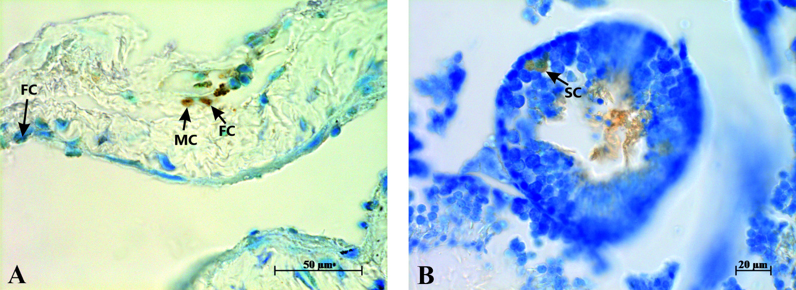 Immunohistochemistry results. Presence of FSH receptors in
mouse penile tissue. (A) Minimal positive staining is detected in fibrocytes (FC)
and mast cells (MC) of the mouse penis. (B) Prominent positive immunoreaction was
observed in the Sertoli cells (SC) of seminiferous tubules.