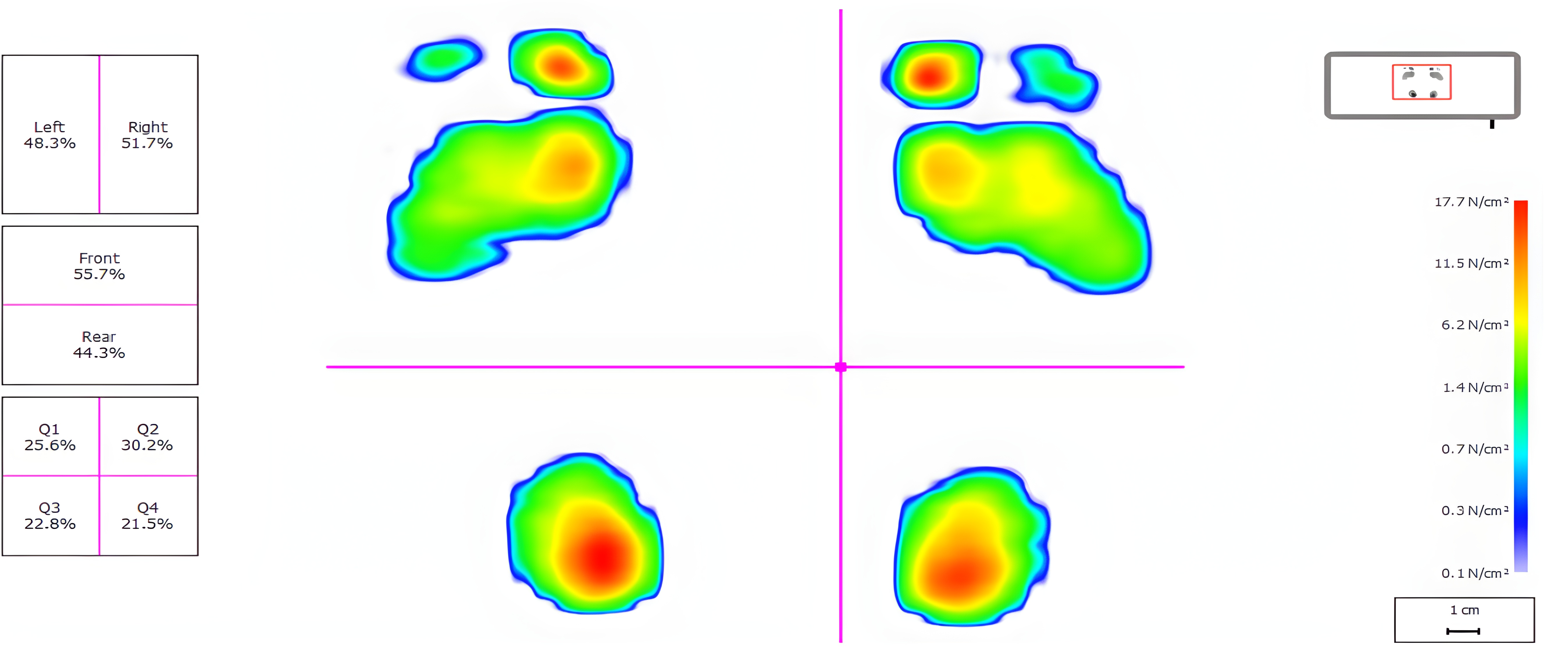 RSscan V9 regional pressure distribution map.