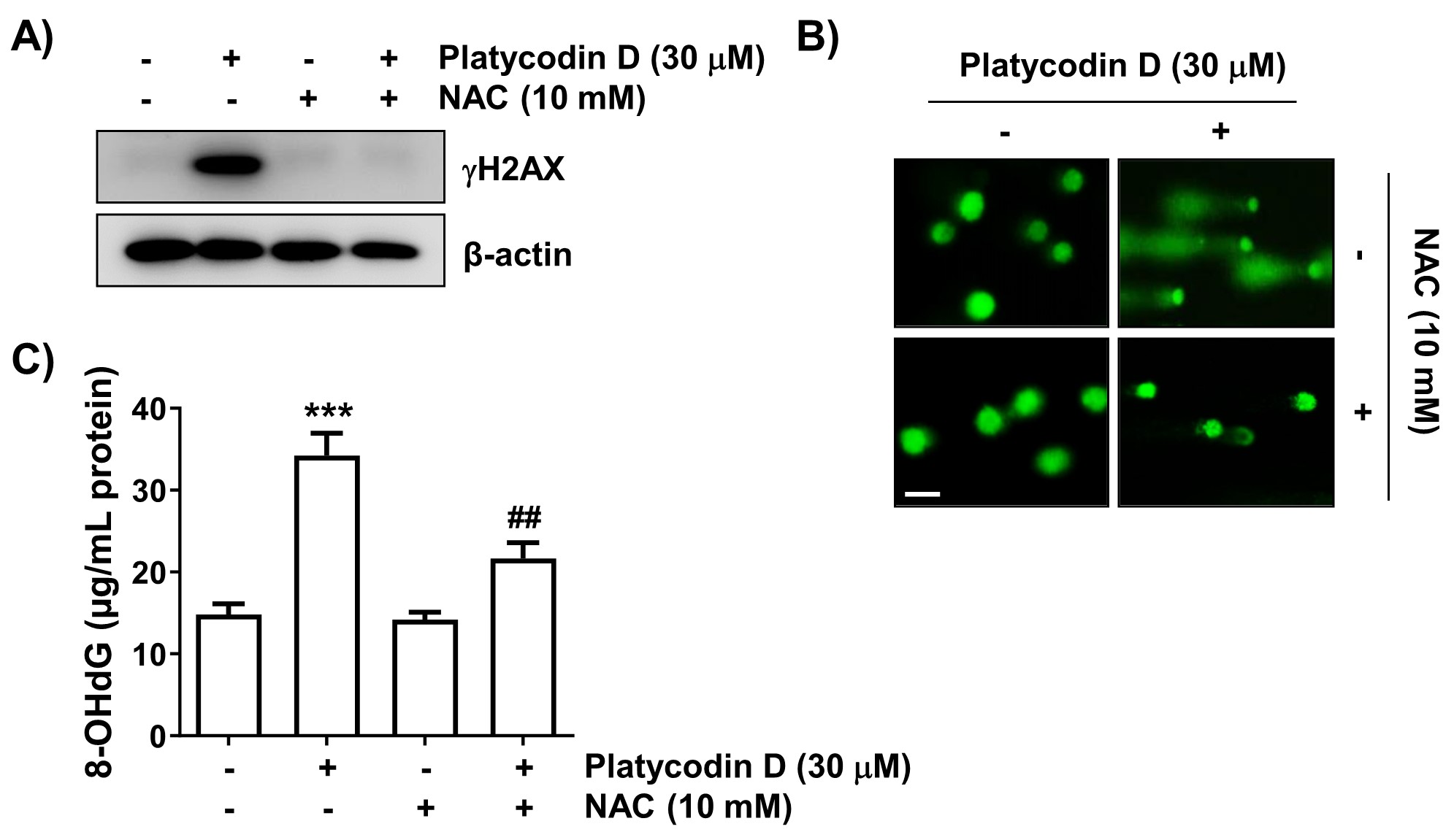 Induction of ROS-dependent DNA damage in platycodin D-treated
PC-3 cells. Cells were pretreated or not with 10 mM NAC for 1 h and then treated
with 30 μM platycodin D for 48 h. (A) Immunoblotting was performed to
evaluate changes in the expression of phosphorylated H2AX (γH2AX). (B,C) DNA
damage was evaluated by the comet assay (Scale bar: 100 μm) and
8-hydroxy-2′-deoxyguanosine (8-OHdG) levels. (B) Representative fluorescence
images from the comet assay are shown. (C) Nuclear 8-OHdG levels were determined
using an enzyme-linked immunosorbent assay kit. The results are presented as mean
± SD (n = 3). ***p < 0.001 versus control cells,
##p < 0.01 versus platycodin D-treated cells. NAC:
N-acetyl-L-cysteine.