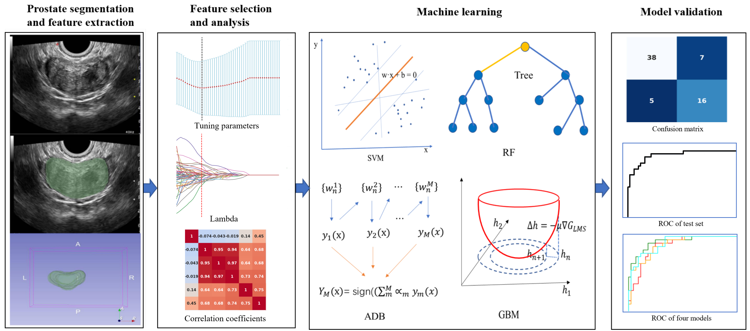Overall study flowchart, 
including feature extraction, feature selection, machine learning and model 
validation. ADB: adaptive boosting; RF: random forest; GBM: gradient boosting 
machine; ROC: receiver operating characteristic; AUC: area under the curve; SVM: 
support vector machine; TPR: true positive rate; MSE: mean square error.
