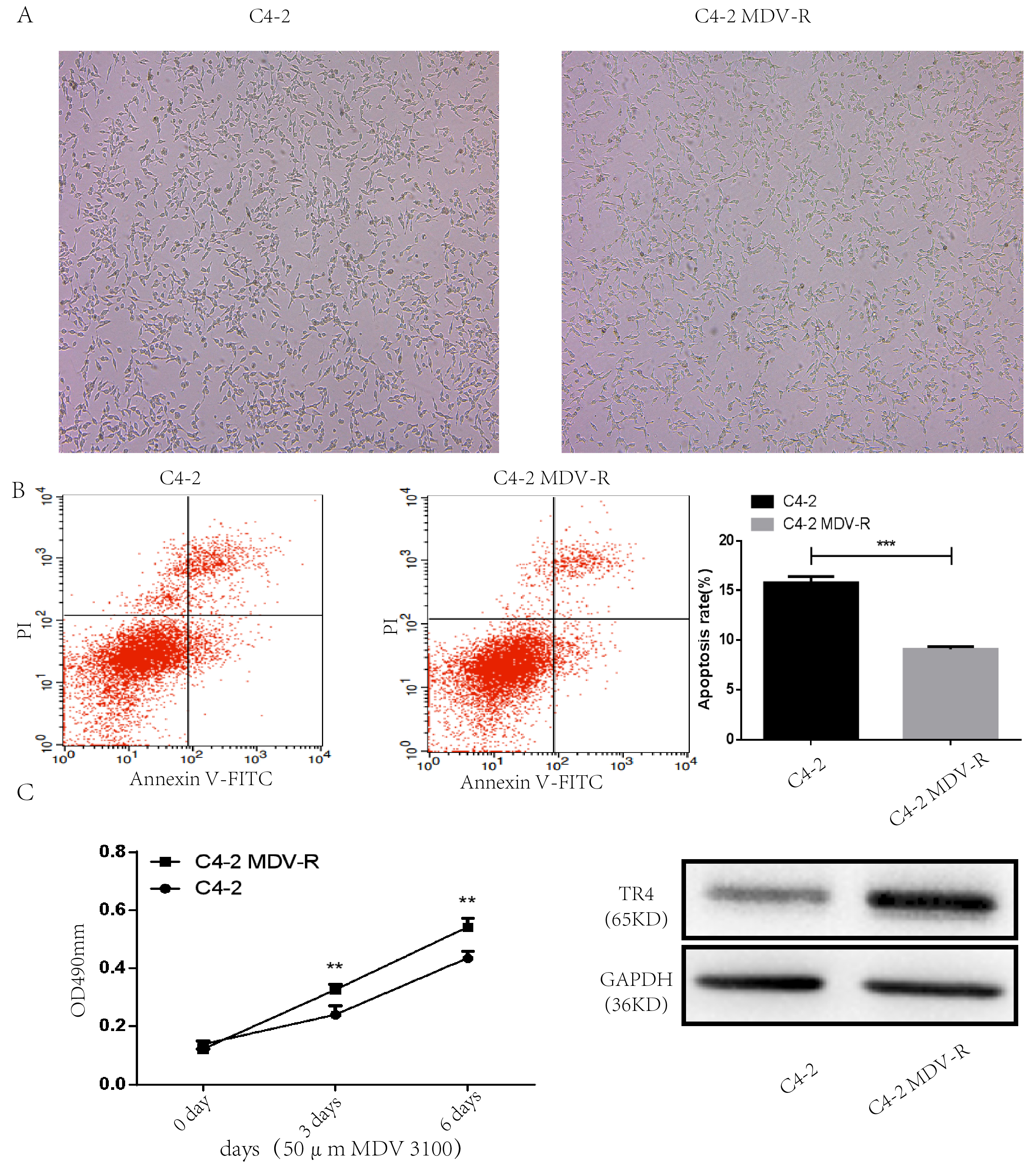 TR4 expression is notably higher in
enz-resistant C4-2 MDV-R cells than in normal C4-2 PCa cells. (A) Morphological characteristics of normal C4-2 PCa cells and
MDV-R cells (70% confluence, 40×). (B) Flow
cytometric analysis of cell apoptosis rate in normal C4-2 PCa cells and MDV-R
cells after treatment with 25 μM enz. (C)
MTS assay was used to assess the sensitivity
of MDV-R and normal C4-2 PCa cell lines to enz. (D) Western
blot of TR4 expression. **p < 0.01, ***p
< 0.001. MDV-R cell: Enzalutamide-resistant cell lines; TR4: Testicular
Nuclear Receptor-4; GAPDH: Glyceraldehyde-3-Phosphate Dehydrogenase; OD: Optical
Density; PI: Propidium Iodide; Annexin V-FITC: Annexin V-Fluorescein Isothiocyanate.