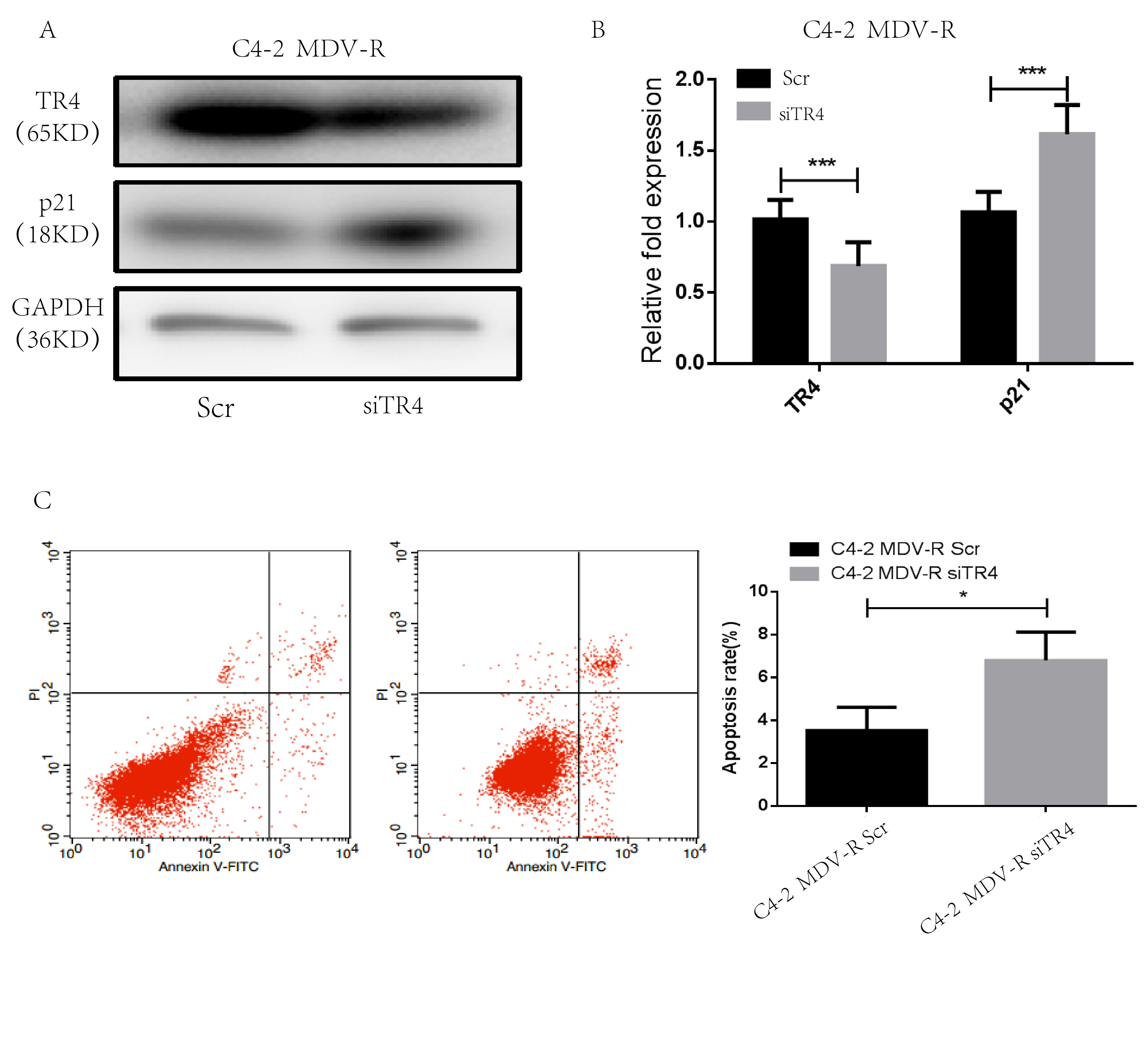 Targeting TR4 in C4-2 MDV-R cells increase apoptosis induced by
enz. (A,B) TR4 and p21 expression of C4-2 MDV-R cells was measured using qPCR
and Western blotting after TR4 knockdown. (C) Flow cytometric assessment of
apoptosis in C4-2 MDV-R Scr/C4-2 MDV-R siTR4 cells.
***: p < 0.001. TR4: Testicular Nuclear
Receptor-4; GAPDH: Glyceraldehyde-3-Phosphate Dehydrogenase;
MDV-R cell: Enzalutamide-resistant cell lines; PI: Propidium
Iodide; Annexin V-FITC: Annexin V-Fluorescein Isothiocyanate.
