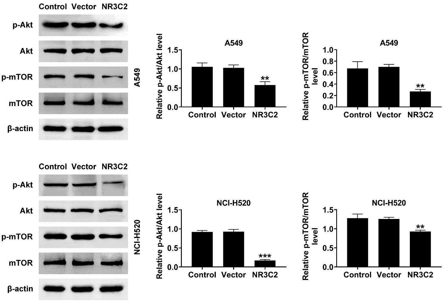 NR3C2 modulates the Akt pathway in NSCLC cells. Western blot
analyses was used to detect the protein expressions of p-Akt, Akt, p-mTOR and
mTOR in A549 and NCI-H520 cells. **p < 0.01,
***p < 0.001 vs. control. NR3C2: Nuclear Receptor
Subfamily 3 Group C Member 2; mTOR: mammalian target of rapamycin; Akt: Protein kinase B.