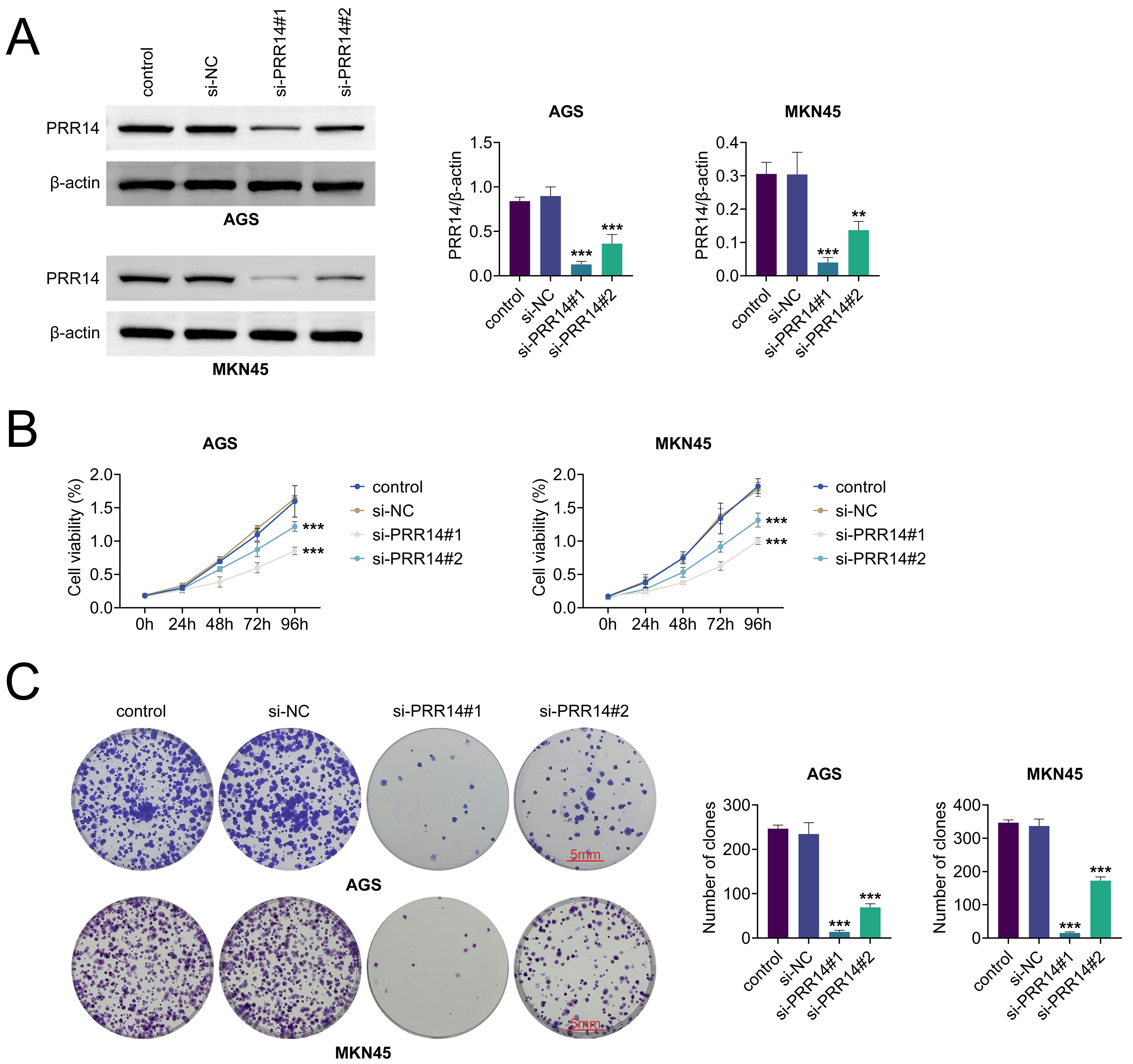 Knockdown of PRR14 suppressed the growth of gastric cancer
cells. (A) Protein expression of PRR14 in cells transfected with si-PRR14 was
detected by western blot. (B) CCK8 was used to detect the cell viability of cells
transfected with si-PRR14 at different time points. (C) The number of crystal
violet in cells transfected with si-PRR14 was detected by clone formation assay.
vs. control, **: p < 0.01, ***: p
< 0.001.
si-NC:
si-control; PRR14: proline-rich protein 14; β-actin: beta-Actin.