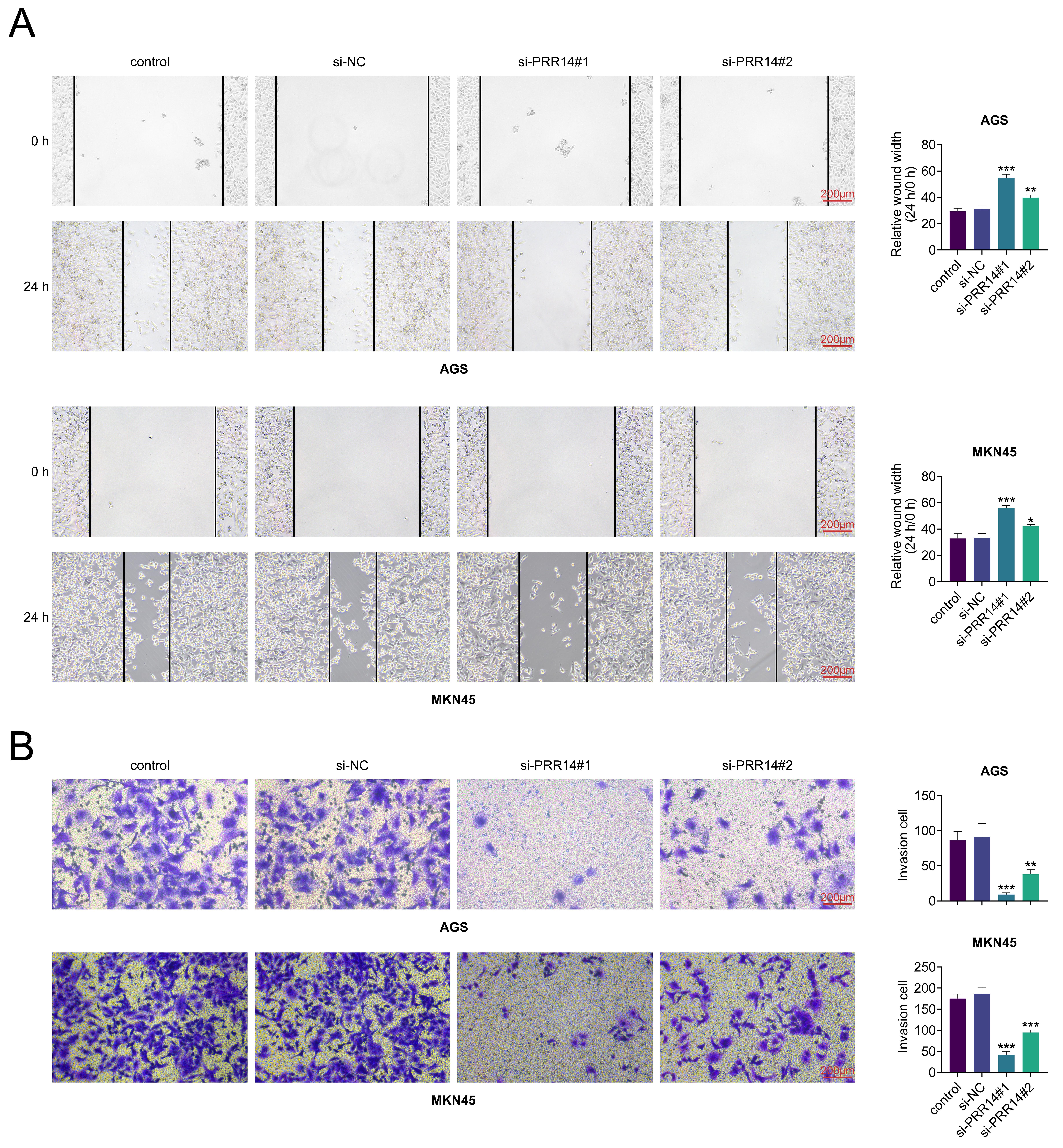 Knockdown of PRR14 inhibited migration and invasion of gastric
cancer cells. (A) Assay to identify cell migration following si-PRR14
transfection. (B) Transwell assay to detect the invasion of cells after
transfection with si-PRR14. vs. control, *: p <
0.05, **: p < 0.01, ***: p <
0.001. si-NC: si-control; PRR14: proline-rich protein 14.