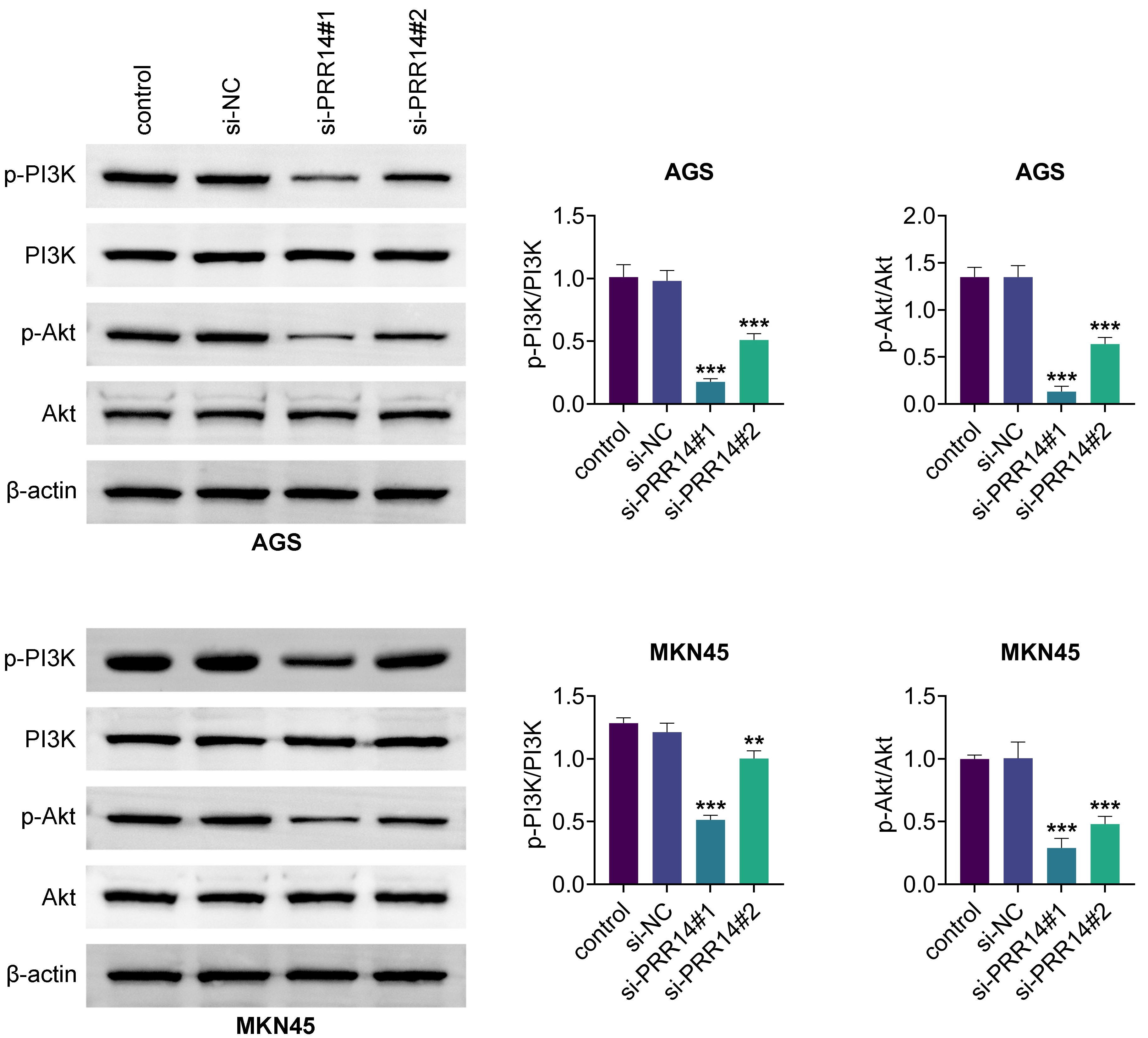 Knockdown of PRR14 downregulated the PI3K/Akt signaling pathway. Proteins linked to the PI3K/Akt pathway (p-PI3K, PI3K, p-Akt and Akt) were
analyzed by Western blot in gastric cancer cells transfected with si-PRR14 in
comparison to the si-NC group. **: p < 0.01,
***: p < 0.001. si-NC: si-control; PRR14:
proline-rich protein 14; PI3K: phosphatidylinositol 3-kinase; Akt: protein kinase
B; β-actin: beta-Actin.