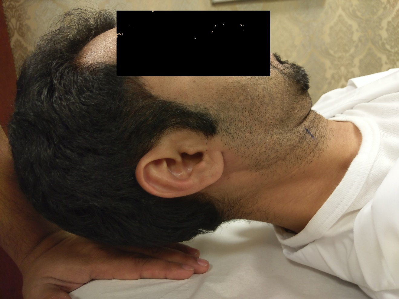 Participant position for the neck flexor muscle endurance test.
The examiner’s hand is positioned to detect changes in the participant’s head
position.