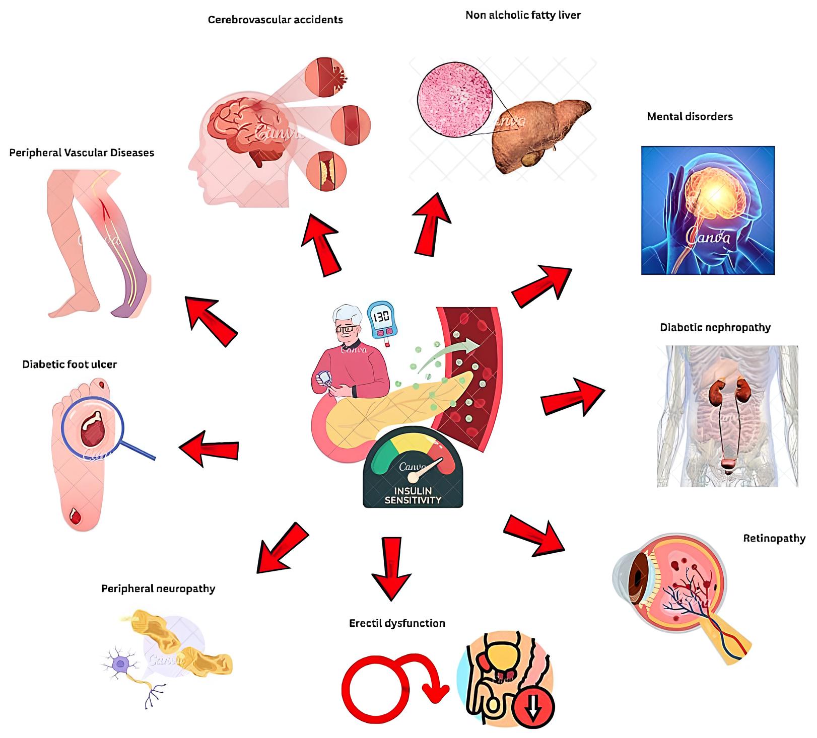 Diabetes related complications among men.