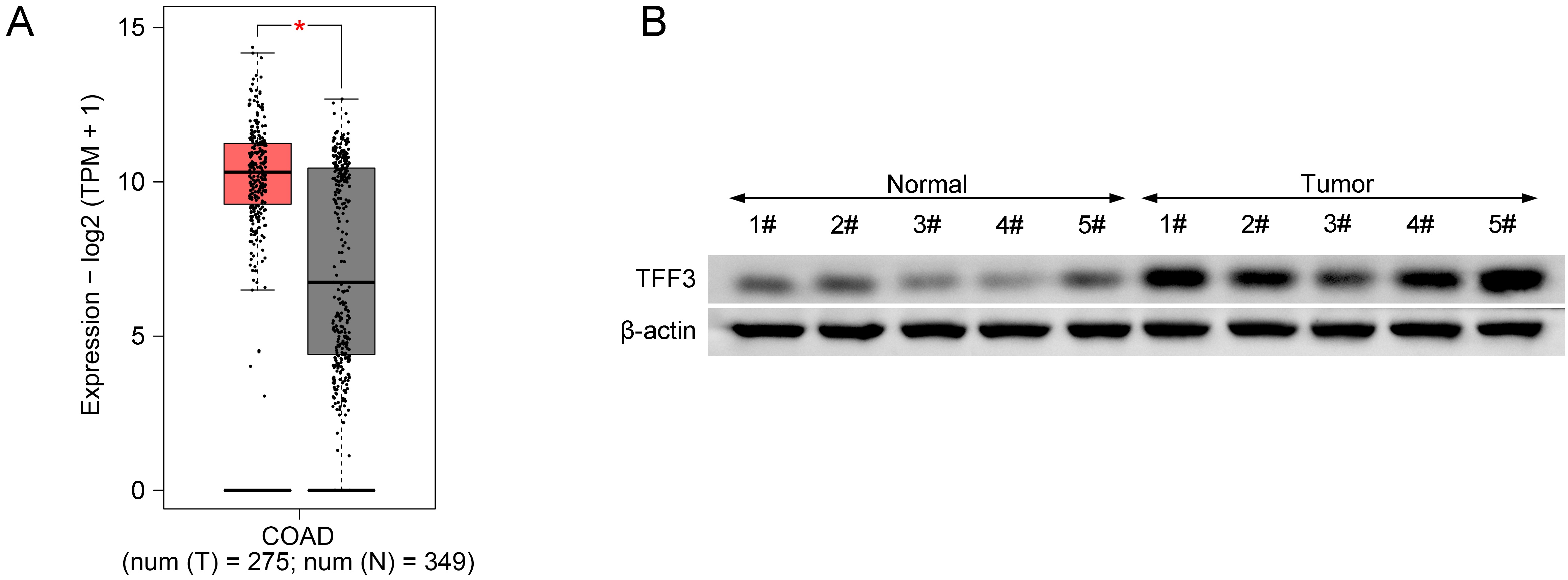 Overexpressed TFF3 in CRC tissue. (A) GEPIA online
database was used to analyze TFF3 expression in normal and colon
adenocarcinoma (COAD) tissues. *p < 0.05. (B) Western
blotting was employed to examine TFF3 protein levels in normal (n = 20) and CRC
tissues (n = 20). TFF: Trefoil factor; TPM:
Transcripts per million.
