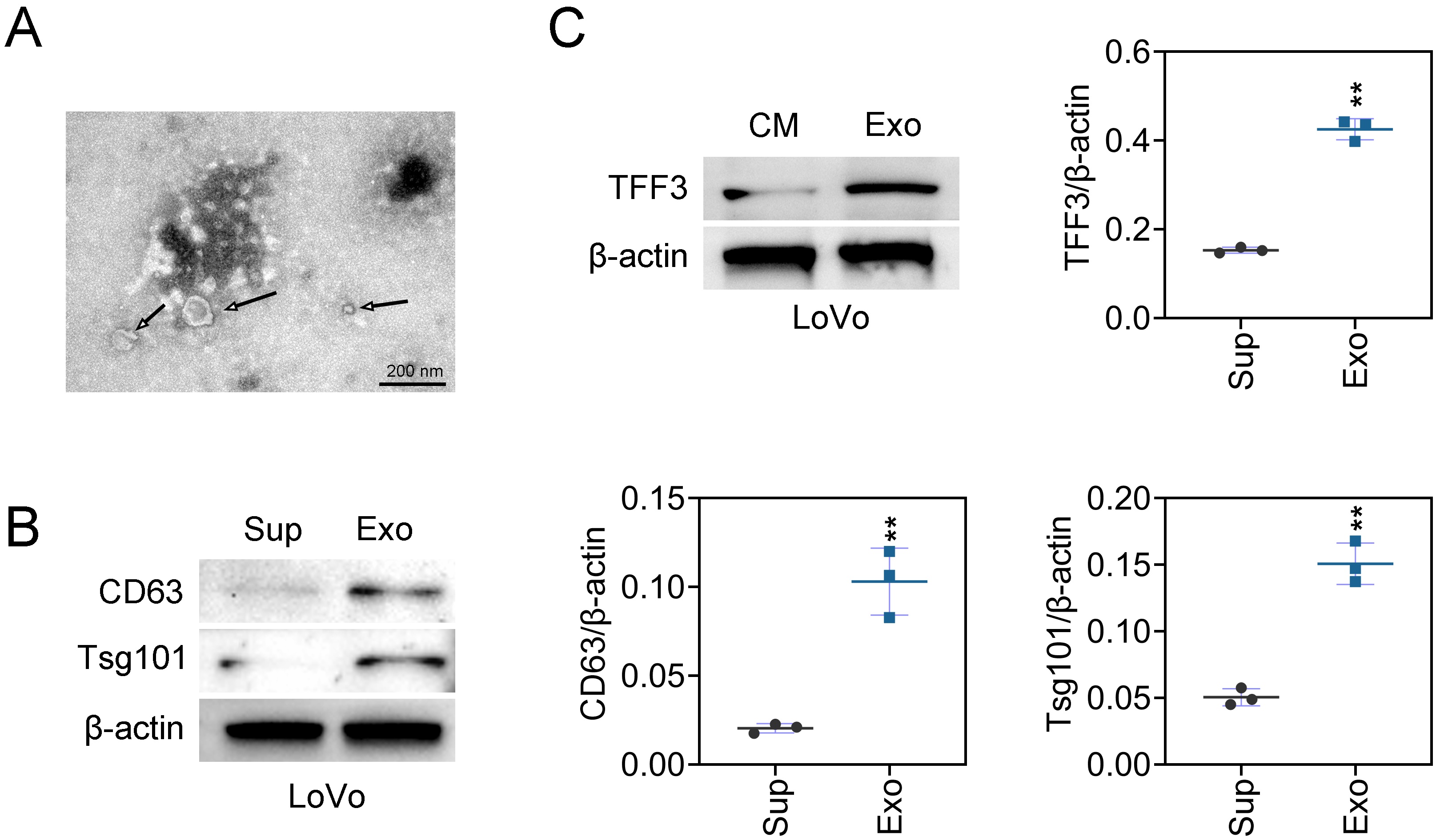 TFF3 is upregulated in CRC-derived exosomes. (A)
Isolated exosomes’ morphology was confirmed by TEM. Arrows indicated exosomes.
Scale bar = 200 nm. (B) Protein expressions of Tsg101 and CD63 exosomal markers
were detected by western blotting (n = 3). (C) TFF3 protein expression in
CRC-derived exosomes was evaluated through western blotting (n = 3). **p
< 0.01. TFF: Trefoil factor; CD: Cluster of
differentiation; Sup: Supernatant; Exo: Exosomes; CM:
Conditioned medium; Tsg: Tumor susceptibility
gene.