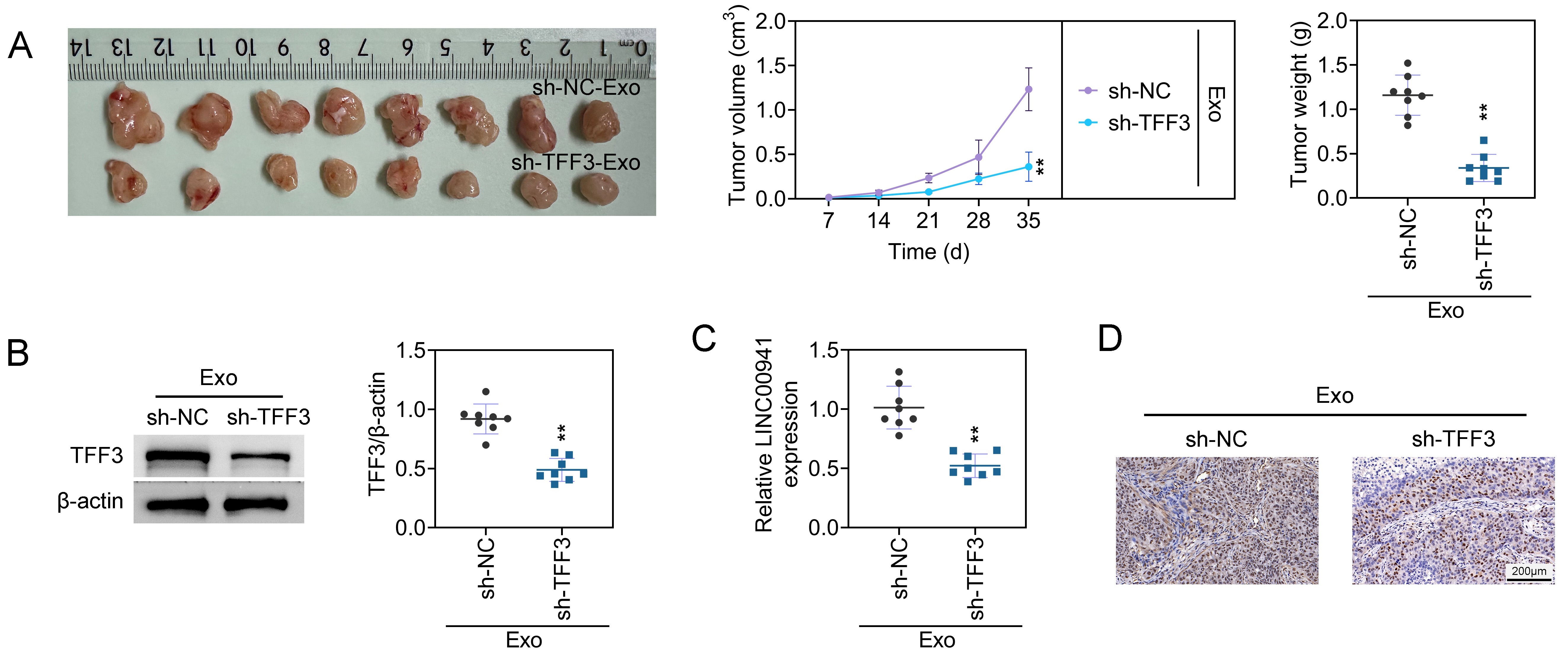 Exosomal TFF3 promotes tumor growth in vivo.
Groups had been segregated to sh-TFF3-Exo and sh-NC-Exo group. (A) Tumor growth
in mice was evaluated. (n = 8). (B) TFF3 protein expressions were evaluated by
western blotting. (n = 8). (C) LINC00941 expression had been confirmed
via RT-qPCR. (n = 8). (D) The Ki67 expression was determined through IHC assay.
Scale Bar = 200 μm. (n = 8). **p < 0.01. TFF: Trefoil
factor; Exo: Exosomes; sh-NC: shRNA-negative control.