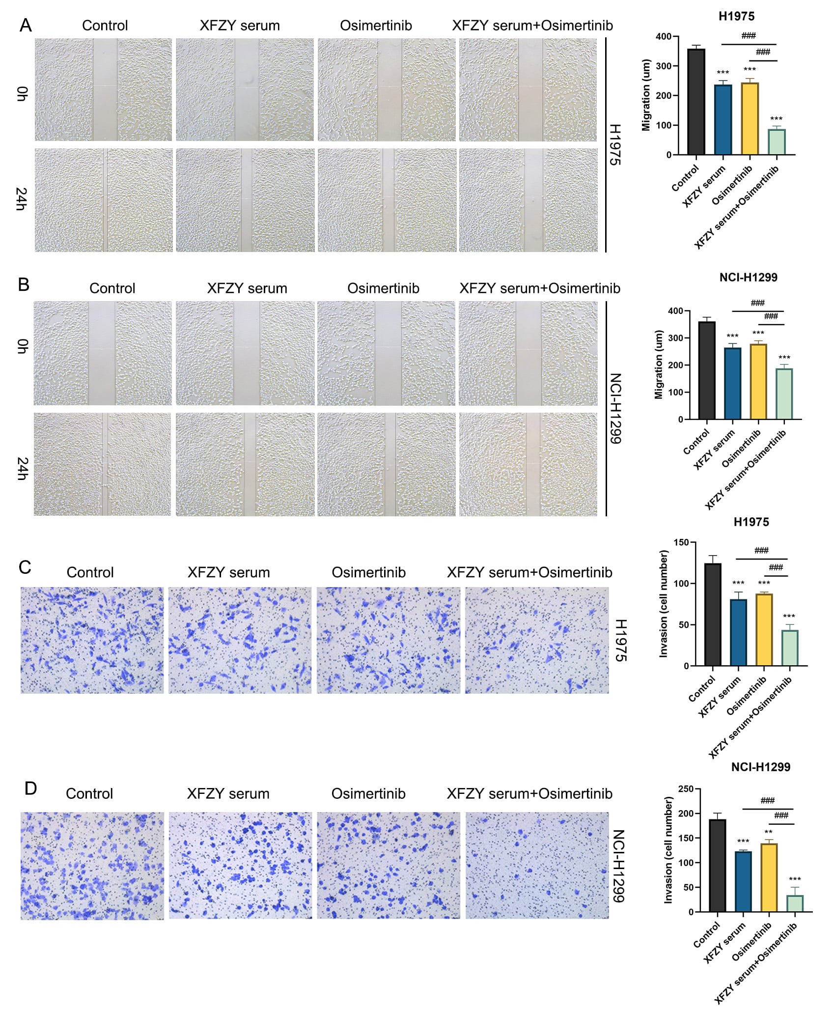 The effect of the combination of XFZY serum and Osimertinib on
the migration and invasion of NSCLC cell lines. XFZY serum-treated H1975 and
NCI-H1299 cell lines with or without Osimertinib. A scratch assay was performed
to detect the migration of (A) H1975 and (B) NCI-H1299 cells. Transwell assays
were performed to detect the invasion of (C) H1975 and (D) NCI-H1299 cells.
Compared with the control group, **p < 0.01,
***p < 0.001; compared with the XFZY serum + Osimertinib
group, ###p < 0.001. XFZY: XueFu ZhuYu; NCI: National Cancer
Institute.