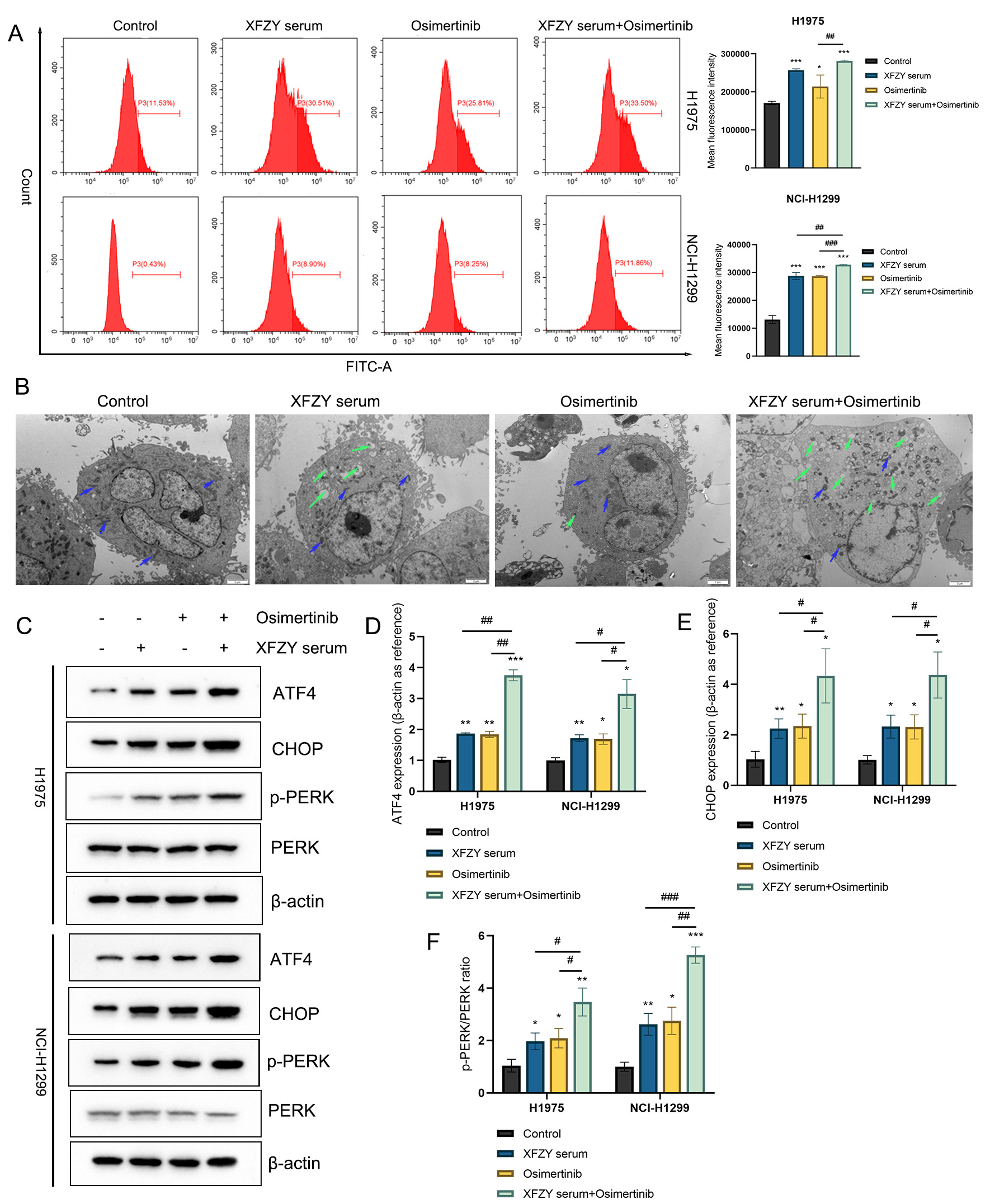 The effect of the combination of XFZY serum and Osimertinib on
ERS in NSCLC cell lines. XFZY serum-treated H1975 and NCI-H1299 cell lines with
or without Osimertinib. (A) ROS production was quantified by flow cytometry. (B)
TEM was used to observe the morphology of the ER (green arrows) and Mitochondria
(blue arrows); scale bar = 2 μm; (C) WB was performed to detect the
expression of proteins, including (D) ATF4 and (E) CHOP, and (F) the p-PERK/PERK
ratio. Compared with the control group, *p < 0.05,
**p < 0.01, ***p < 0.001; compared with
the XFZY serum + Osimertinib group, #p < 0.05,
##p < 0.01, ###p < 0.001. XFZY: XueFu ZhuYu;
NCI: National Cancer Institute; FITC-A: Fluorescein Isothiocyanate-Area; ATF4:
Activating Transcription Factor 4; CHOP: C/EBP Homologous Protein; p-PERK:
phosphorylated PKR-like ER kinase.