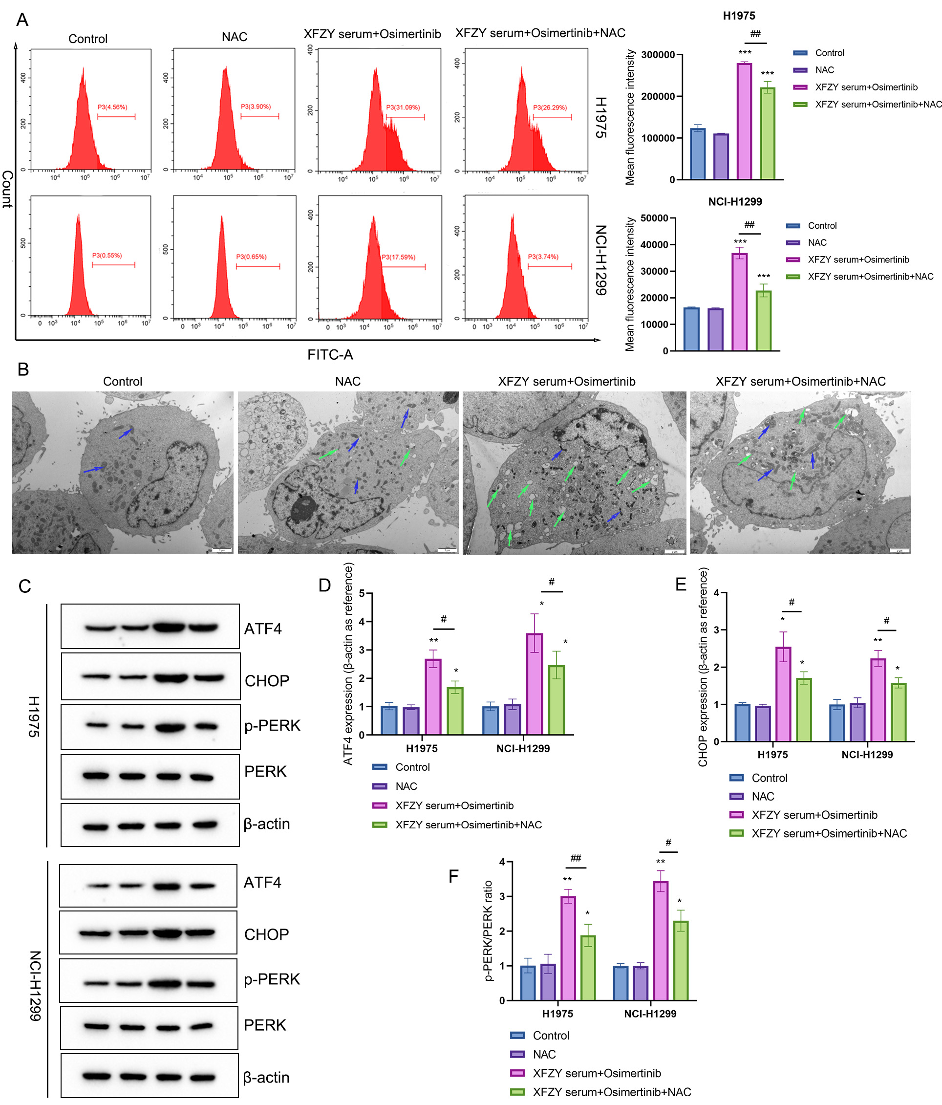 The combination of XFZY serum and Osimertinib promoted ERS in
NSCLC cell lines by promoting ROS production. The combination of XFZY serum and
Osimertinib was used to treat H1975 and NCI-H1299 cell lines with or without
NAC. (A) ROS production was quantified by flow cytometry. (B) TEM was
used to observe the morphology of the ER (green arrows) and Mitochondria (blue
arrows); scale bar = 2 μm. (C) WB was performed to detect the
expression of proteins, including (D) ATF4 and (E) CHOP, and (F) the p-PERK/PERK
ratio. Compared with the control group, *p < 0.05,
**p < 0.01, ***p < 0.001; compared with
the XFZY serum + Osimertinib group, #p < 0.05, ##p < 0.01. XFZY: XueFu ZhuYu;
NAC: N-acetylcysteine; NCI: National Cancer Institute; FITC-A:
Fluorescein Isothiocyanate-Area; ATF4: Activating Transcription Factor 4; CHOP:
C/EBP Homologous Protein; p-PERK: phosphorylated PKR-like ER kinase.