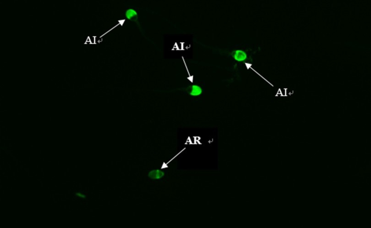 Sperm PSA-FITC staining model (×1000 under confocal
microscope). Spermatozoa with fluorescent coverage >50% on the head is
defined as AI. Spermatozoa with only a fluorescent band at the equatorial segment
or no fluorescence in the acrosomal region is defined as AR. AI: acrosome-intact;
AR: acrosome-reacted.