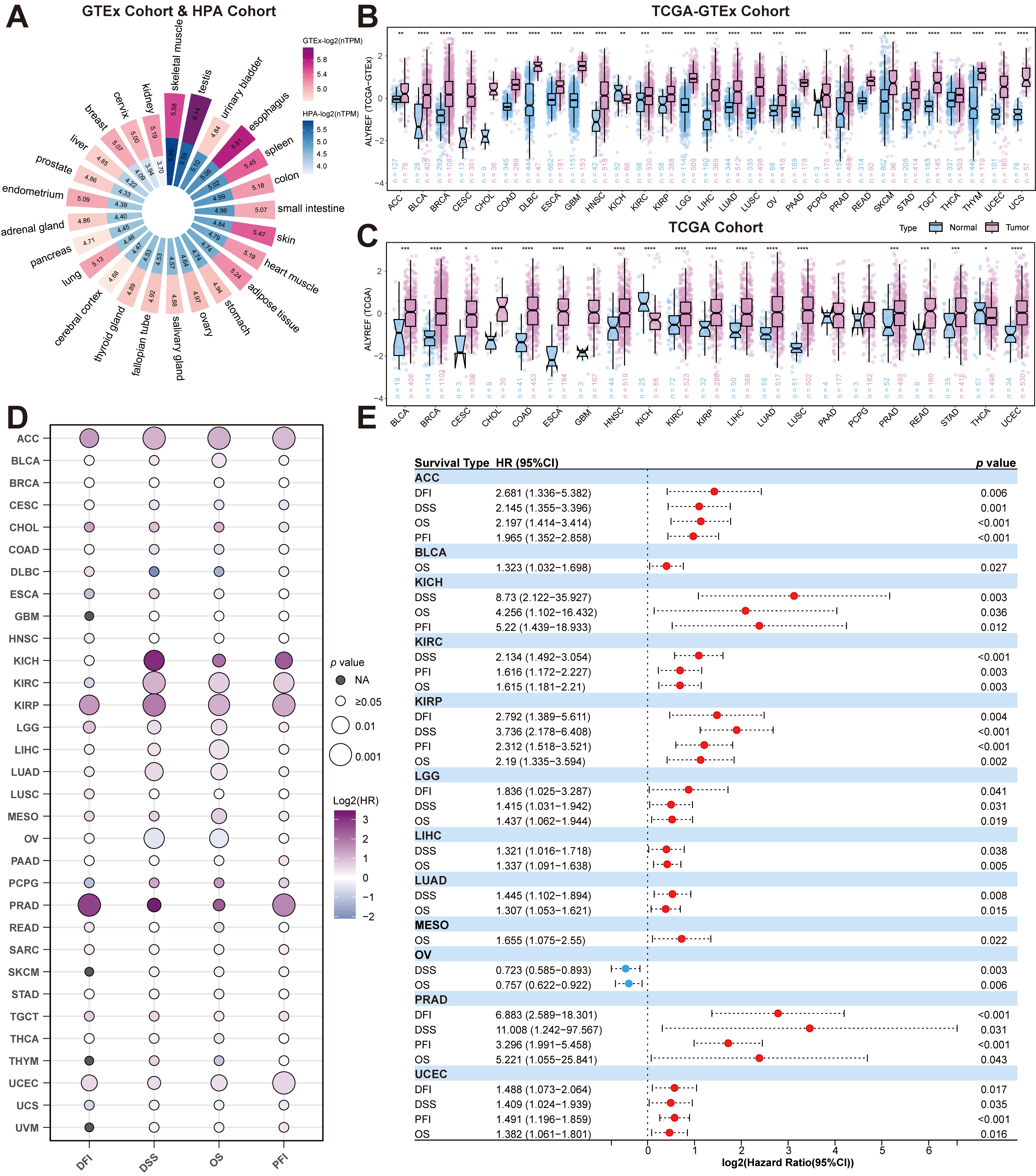 Pan-cancer analysis of ALYREF expression and prognostic
significance. (A) Circular heatmap illustrating the mRNA expression levels of
ALYREF across various normal human tissues. (B) Boxplot comparing
ALYREF expression between tumor and normal tissues. (C) Boxplot
depicting ALYREF expression in tumor versus adjacent non-cancerous
tissues. (D) Dot plot representing hazard ratios (HR) with 95% confidence
intervals (CI) for ALYREF expression across four prognostic endpoints.
(E) Forest plot summarizing survival analysis results, including hazard ratios
(HR) with 95% CI and p-values for each cancer type, with red dots
indicating statistical significance (p < 0.05). ACC: Adrenocortical
carcinoma; BLCA: Bladder urothelial carcinoma; BRCA: Breast invasive carcinoma;
CESC: Cervical squamous cell carcinoma and endocervical adenocarcinoma; CHOL:
Cholangiocarcinoma; COAD: Colon adenocarcinoma; DLBC: Diffuse large B-cell
lymphoma; ESCA: Esophageal carcinoma; GBM: Glioblastoma multiforme; HNSC: Head
and neck squamous cell carcinoma; KICH: Kidney chromophobe; KIRC: Kidney renal
clear cell carcinoma; KIRP: Kidney renal papillary cell carcinoma; LGG: Lower
grade glioma; LIHC: Liver hepatocellular carcinoma; LUAD: Lung adenocarcinoma;
LUSC: Lung squamous cell carcinoma; MESO: Mesothelioma; OV: Ovarian serous
cystadenocarcinoma; PAAD: Pancreatic adenocarcinoma; PCPG: Pheochromocytoma and
paraganglioma; PRAD: Prostate adenocarcinoma; READ: Rectum adenocarcinoma; SARC:
Sarcoma; SKCM: Skin cutaneous melanoma; STAD: Stomach adenocarcinoma; TGCT:
Testicular germ cell tumors; THCA: Thyroid carcinoma; THYM: Thymoma; UCEC:
Uterine corpus endometrial carcinoma; UCS: Uterine carcinosarcoma; UVM: Uveal
melanoma; OS: Overall survival; DSS: Disease-specific survival; DFI: Disease-free
interval; PFS: Progression-free survival; TCGA: The Cancer Genome Atlas; GTEx:
Genotype-Tissue Expression.