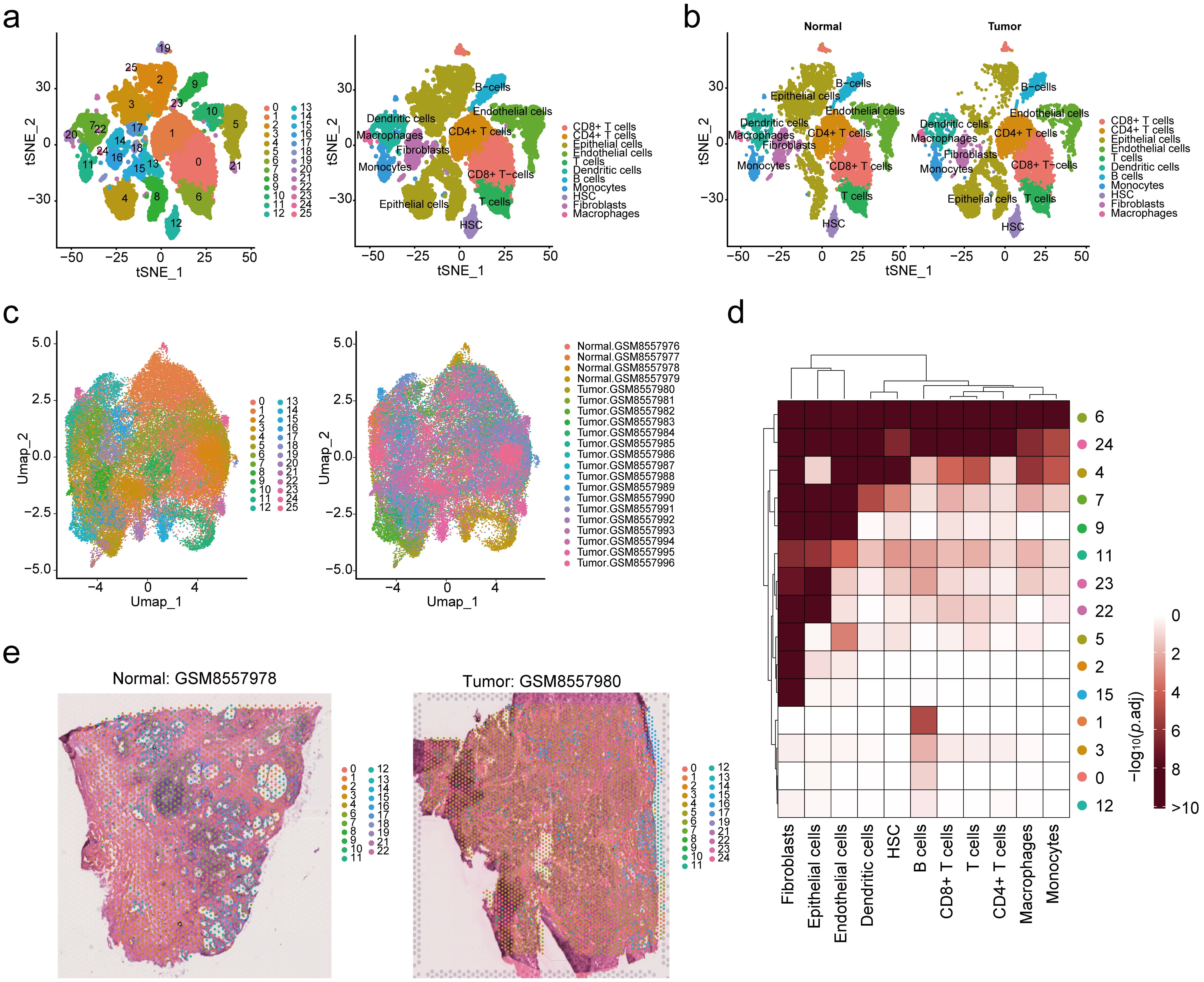 Integration of single-cell RNA-seq and spatial transcriptomics. 
(a) Identification of 25 distinct cell clusters and 11 major cell types from the 
scRNA-seq dataset GSE193337. (b) Comparison of cell distribution patterns between 
normal and tumor samples. (c) Spatial transcriptomics analysis identified 25 
spatially resolved clusters from the ST dataset GSE278936, revealing cellular 
heterogeneity across samples. (d) Annotation of major clusters using MIA 
analysis. (e) Spatial visualization of normal and tumor sample slices.