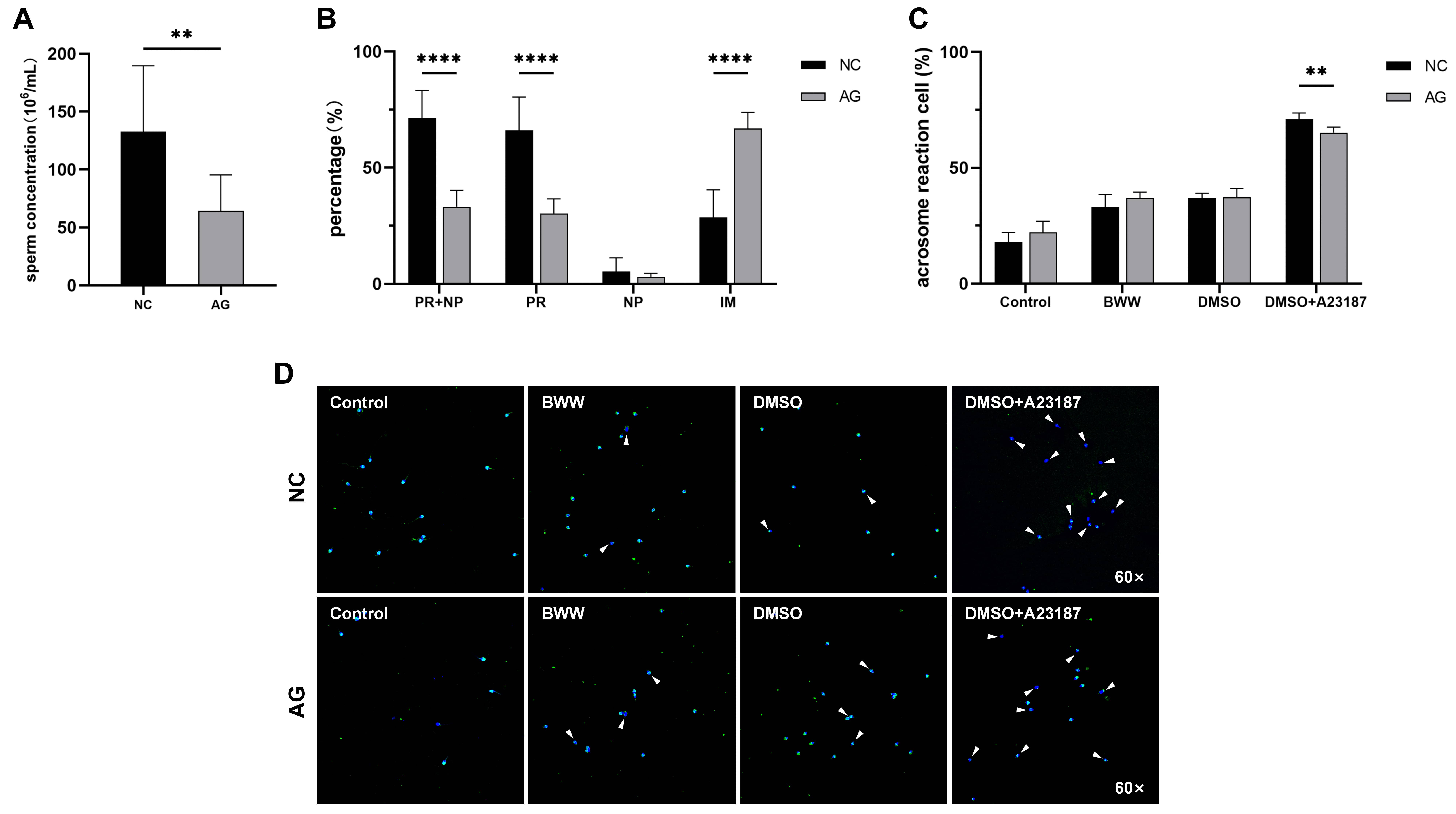 Basic parameters and acrosomal function characteristics of sperm
from asthenozoospermia patients. NC: Negative Control; AG: Asthenozoospermic
Group; Versus control group (**p < 0.01, ****p < 0.0001).
(A) Comparison of sperm concentration between the NC and AG groups. (B)
Comparison of basic semen parameters, including total motility (PR + NP),
progressive motility (PR), non-progressive motility (NP), and immotility (IM),
between the NC and AG groups. (C) Statistical bar chart of spontaneous and
induced acrosome reaction counts in the NC and AG groups. (D) Schematic
fluorescence confocal microscopy images illustrating spontaneous and induced
acrosome reactions. Sperm that had not undergone the acrosome reaction were
characterized by fluorescence over the head’s acrosomal region, whereas
acrosome-reacted sperm were identified by fluorescence only at the equatorial
segment or by a complete absence of fluorescence over the acrosomal region, as
indicated by the arrows. BWW: Biggers-Whitten-Whittingham capacitation medium;
DMSO: dimethyl sulfoxide.