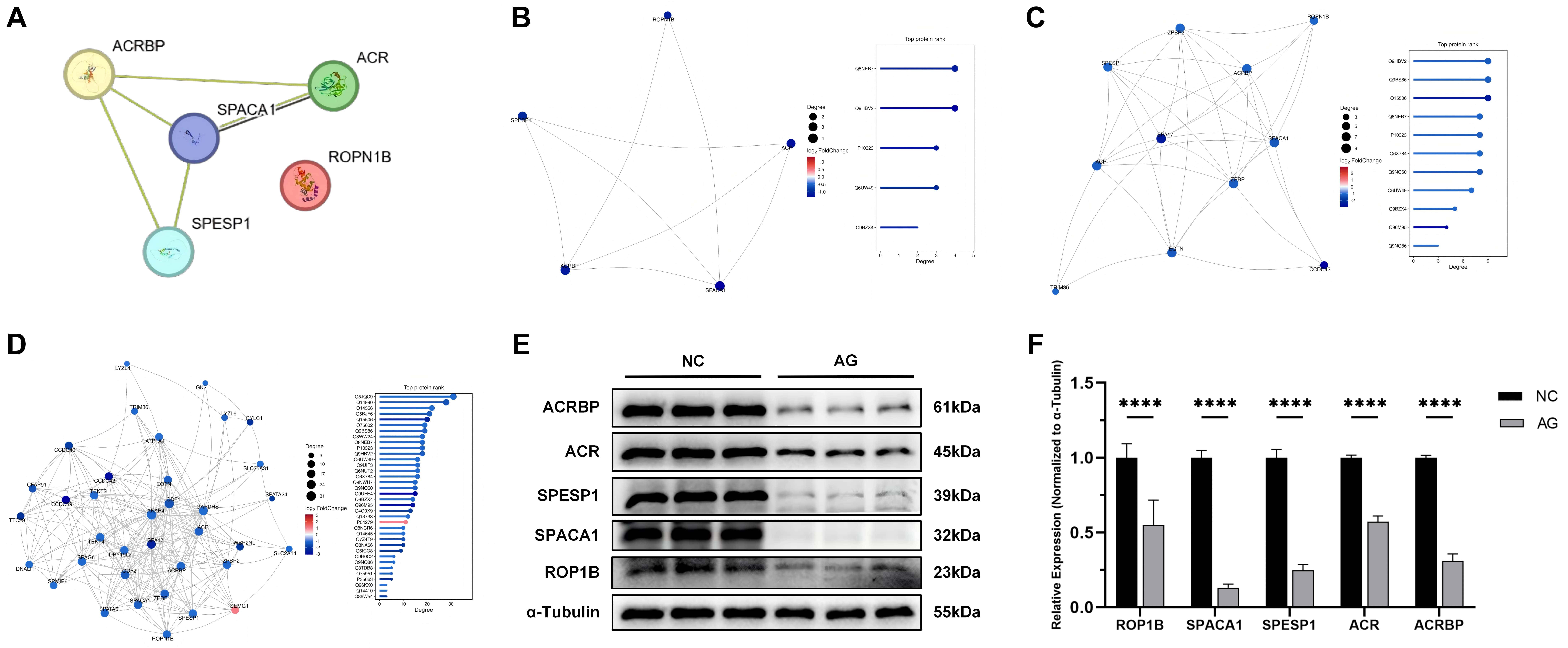 Protein-protein interaction network analysis and validation of a
core acrosomal module in asthenozoospermia. (A) PPI network of the candidate
proteins from the STRING database. Despite the absence of a direct binary link to
ROP1B (UniProt nomenclature, corresponding to ROPN1B in STRING), its
co-downregulation and functional coherence warrant its inclusion in the
functional module. (B–D) Topological analysis demonstrating the hub status of
the core module within PPI networks of increasing scope: (B) the five candidates,
(C) all acrosome reaction-related proteins, and (D) all sperm-related proteins.
The module’s centrality is maintained, highlighting its fundamental role. (E)
Representative Western Blot images of the five core module proteins in normal
(NC) and asthenozoospermic (AG) sperm. (F) Quantitative analysis of Western Blot
data (mean ± SD; unpaired t-test, ****p < 0.0001),
confirming the coordinated downregulation of the entire module in
asthenozoospermia, consistent with proteomic findings. SPACA1: Sperm acrosome
membrane-associated protein 1; SPESP1: Sperm equatorial segment protein 1; ACR:
Acrosin; ACRBP: Acrosin-binding protein; ROP1B: Ropporin-1B; AG: Asthenozoospermia Group; NC: Negative Control.