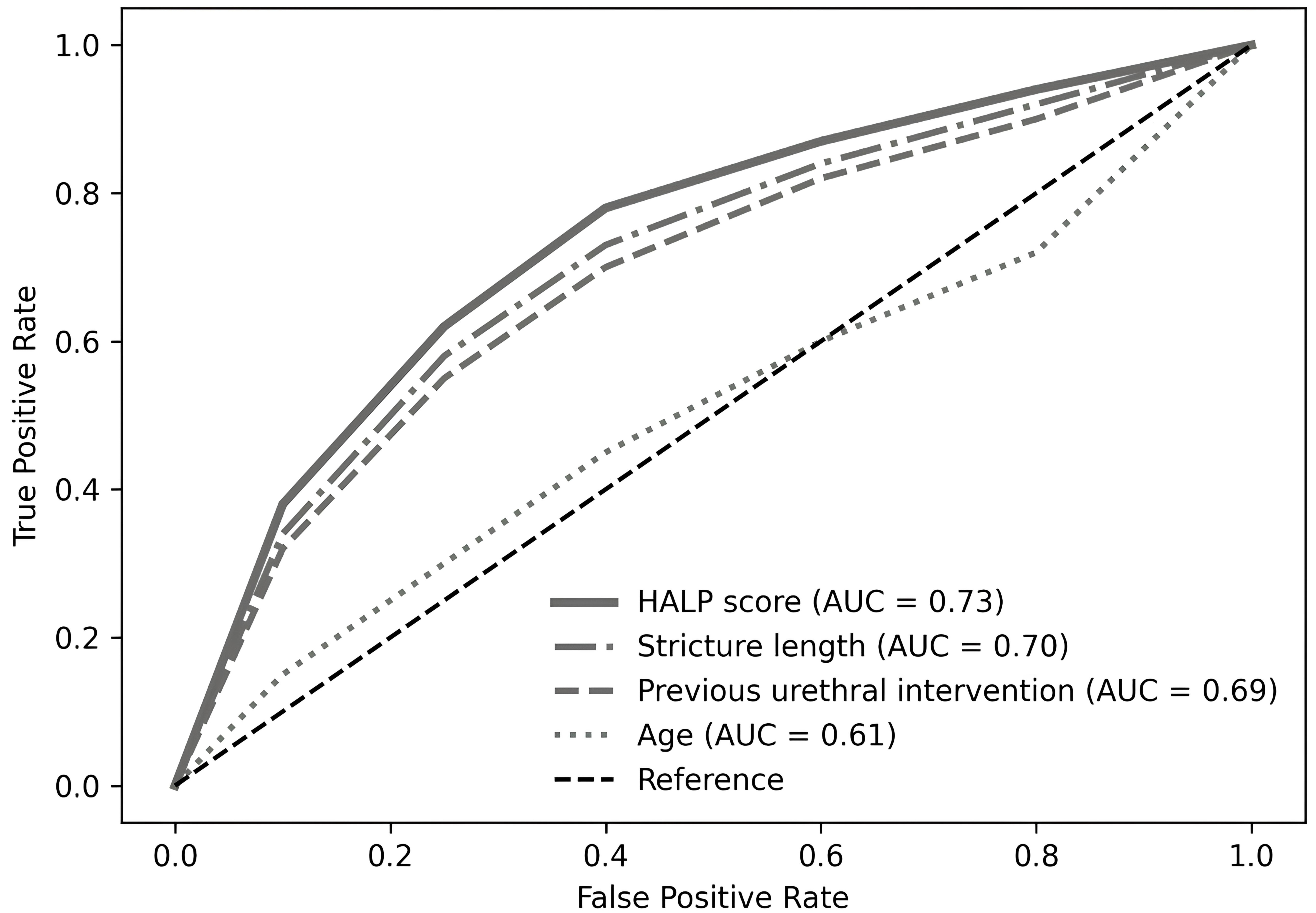 Receiver operating characteristic (ROC) curves illustrating the
predictive performance of the HALP score, stricture length, prior urethral
intervention, and age for urethral stricture recurrence after urethroplasty. The
diagonal dashed line indicates the reference line representing no discriminatory
ability. AUC, area under the curve; HALP, hemoglobin, albumin, lymphocyte, and
platelet score.